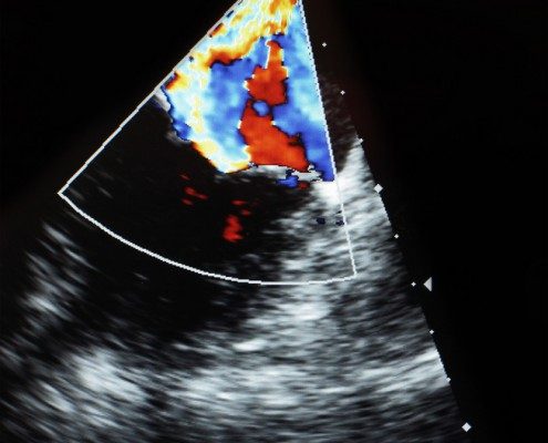 Ultrasound Equipment Mobile Office, NC