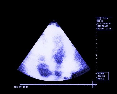 Mobile Ultrasound Imaging Services WNC